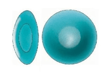 Anterior Subcapsular Cataract
