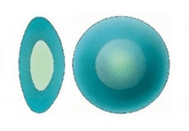 Nuclear Cataract