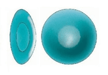 Posterior Subcapsular Cataract