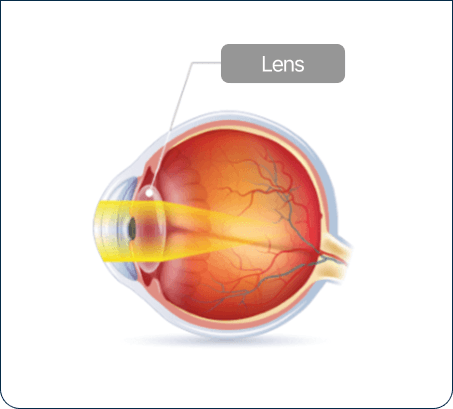 Normal Eye