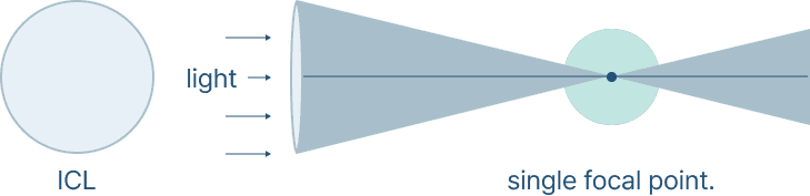 Monofocal Intraocular Lens (ICL)