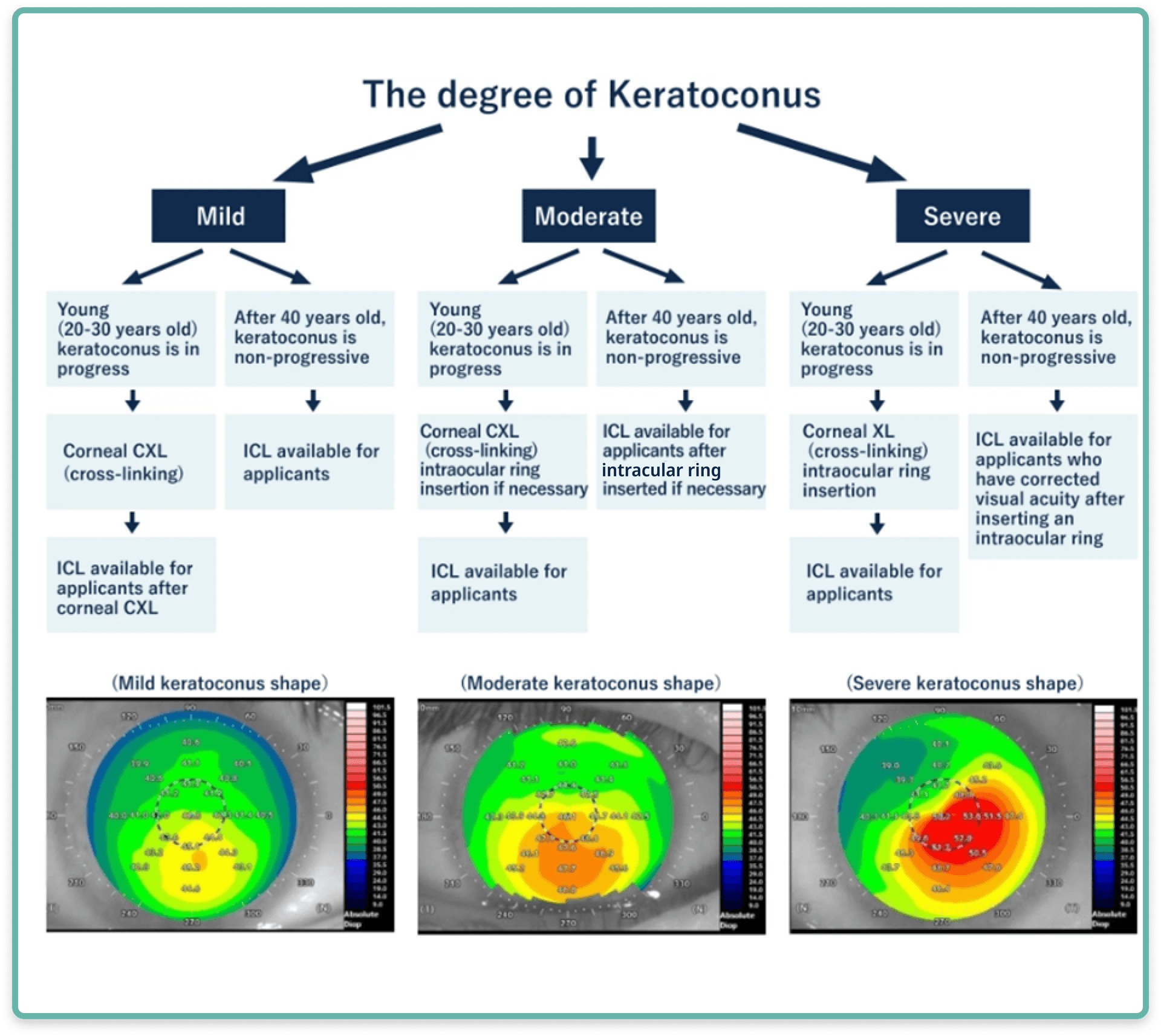 Keratoconus treatment flowchart