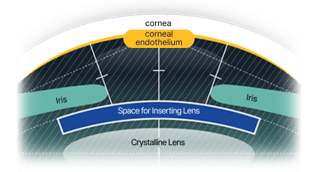 Accurate measurement of intraocular space
