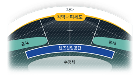 정확한 안구공간 측정