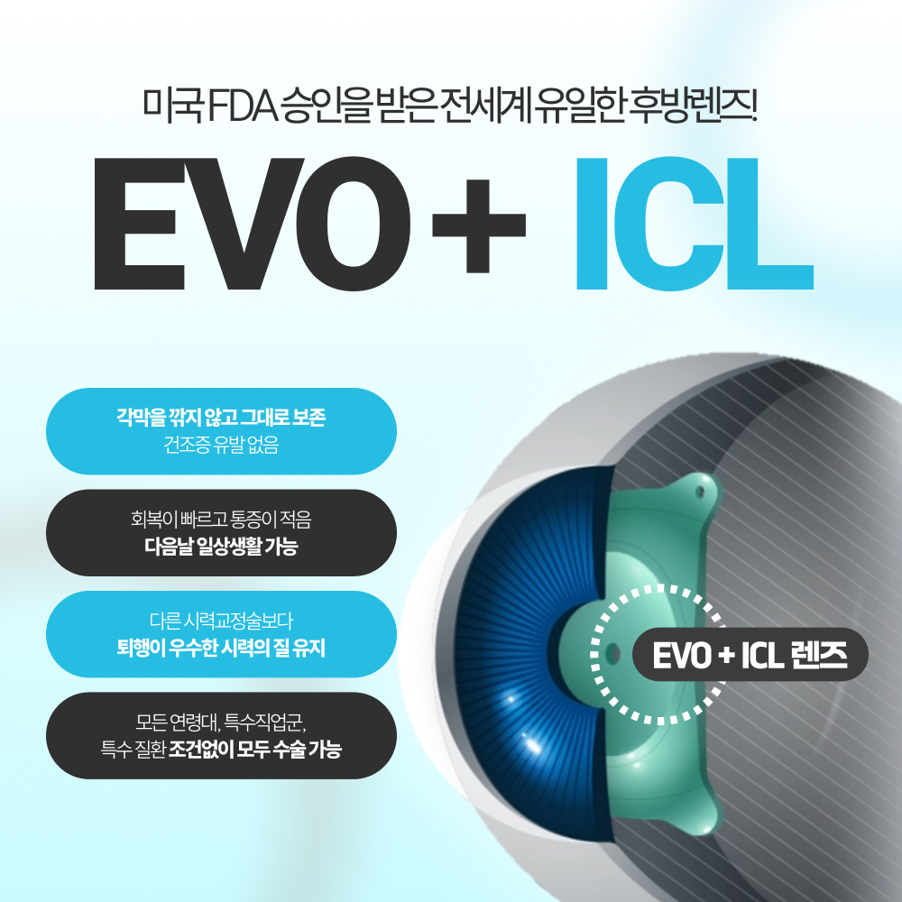 길어진 안구에 맞춘 렌즈 도수 계산